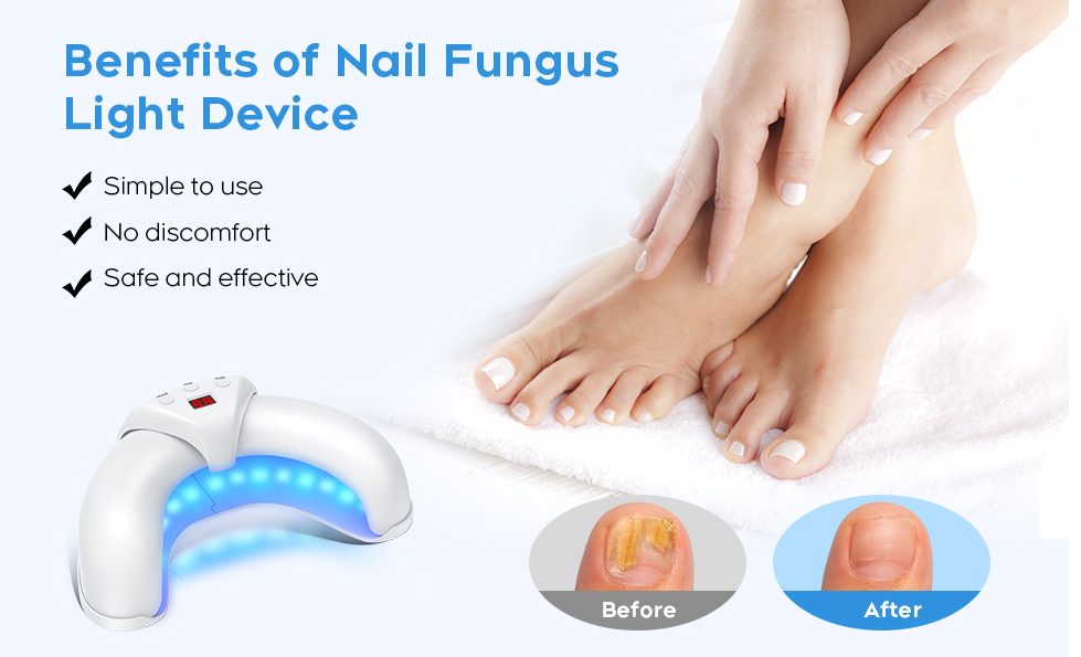 PedKlar® | LLLT-Nagelpilztherapie